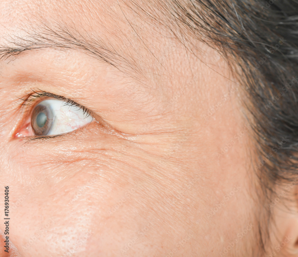 Obraz premium Wrinkles on the eyes