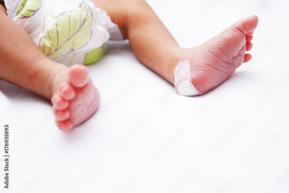Taking a Heel Blood Sample From Newborn Baby Taking a Heel Blood Sample From Newborn Baby