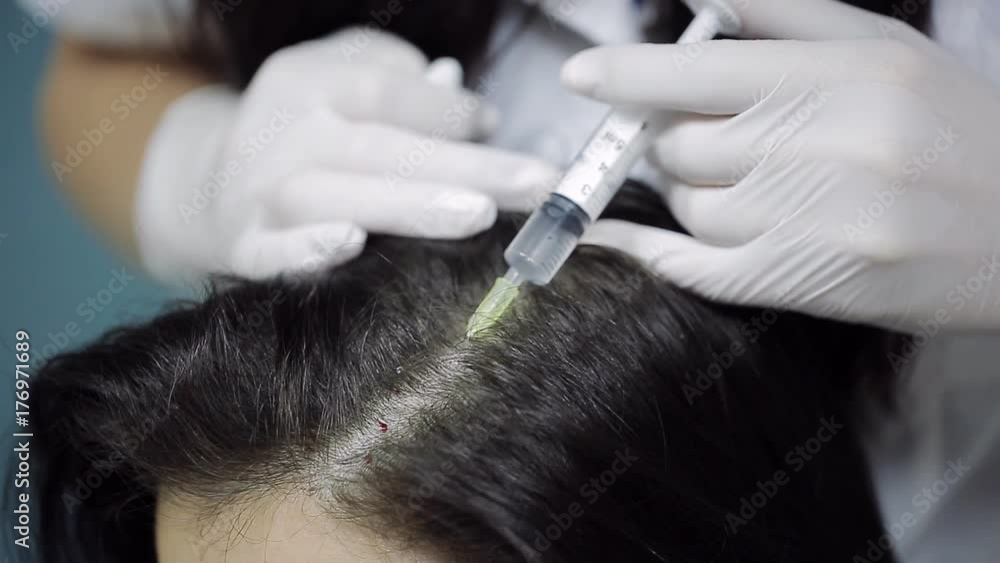 Handsome woman receiving an injection in the head. mesotherapy. Thrust to strengthen the hair and their growth Handsome woman receiving an injection in the head. mesotherapy. Thrust to strengthen the hair and their growth