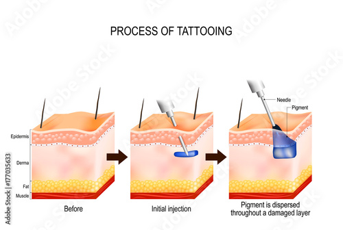 process of tattooing
