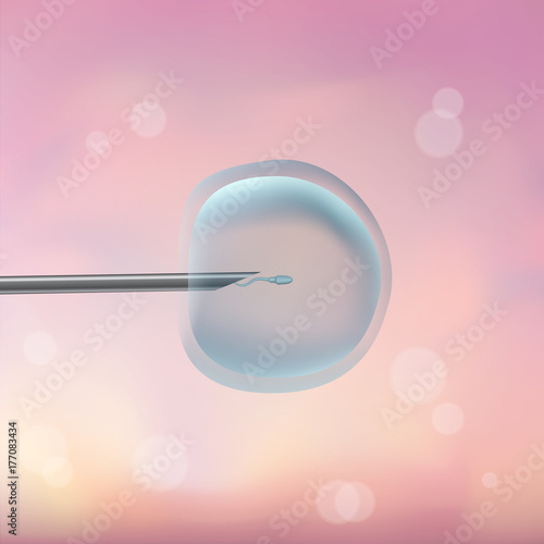 In vitro fertilization IVF. Artificial insemination. ICSI. The ovum egg , needle and spermatozoon. Illustration for web or typography magazine, brochure, flyer, poster. Blurred pink background
