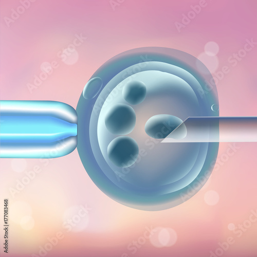 In vitro fertilization IVF, the egg, ovum, pipette and pipe horizontal, reproduction in humans illustration for an article, site, typography magazine, brochure, flyer, poster. Blurred pink background.