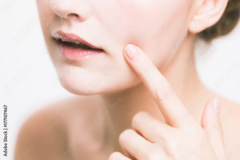 young woman who checks her skin. acne treatment.