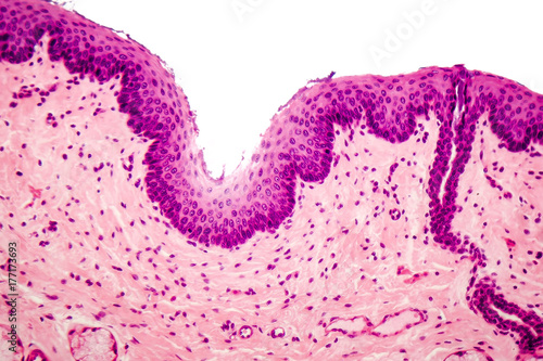 Human stratified squamous epithelium under microscope, light micrograph photo