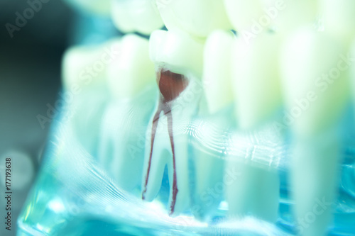 Fotobehang Dental tooth root canal