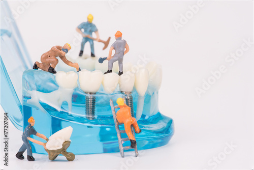 miniature people clean tooth or dental model,medical concept