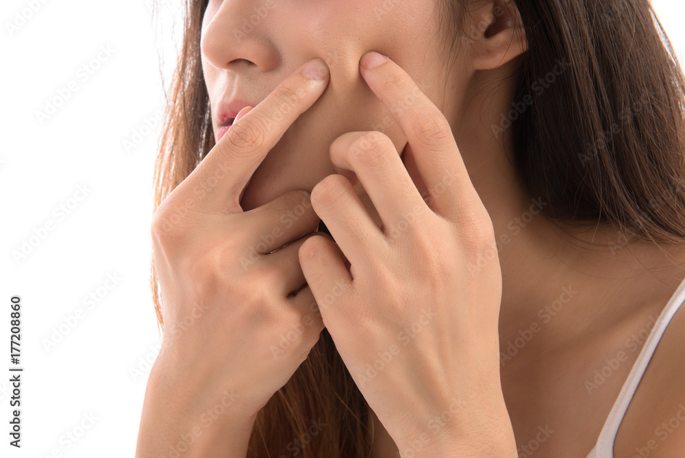 Portrait of asian woman popping pimple isolated on white background. Asian woman having skin problems. Portrait of asian woman popping pimple isolated on white background. Asian woman having skin problems.