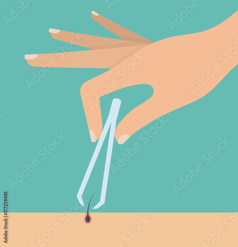 Woman's hand holding tweezers and pulling out a hair from the skin with it