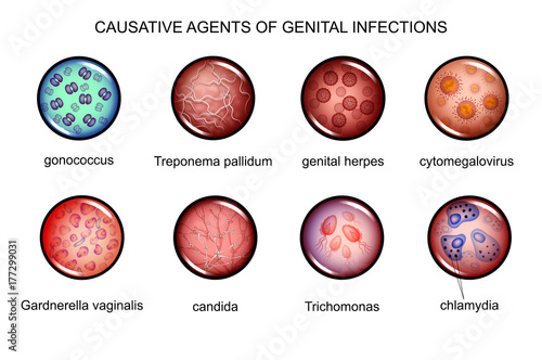 the causative agents of sexually transmitted infections photo