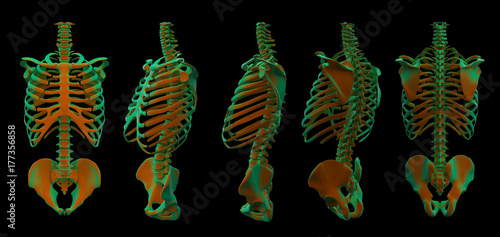3d illustration of  walking fire skeleton by X-rays on background
