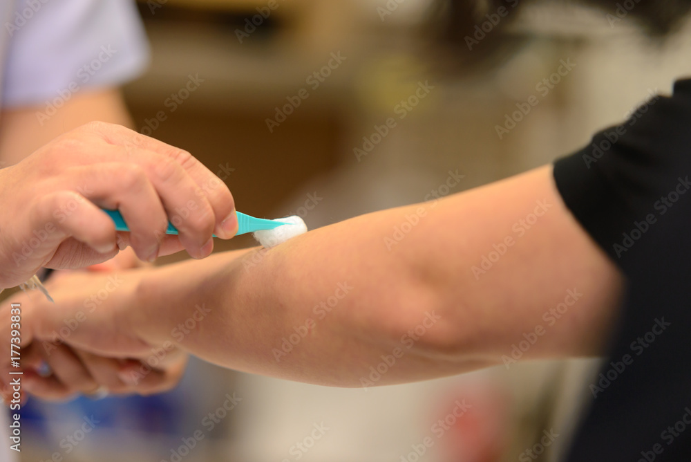 Obraz premium Nurse cleaning wound in the arm