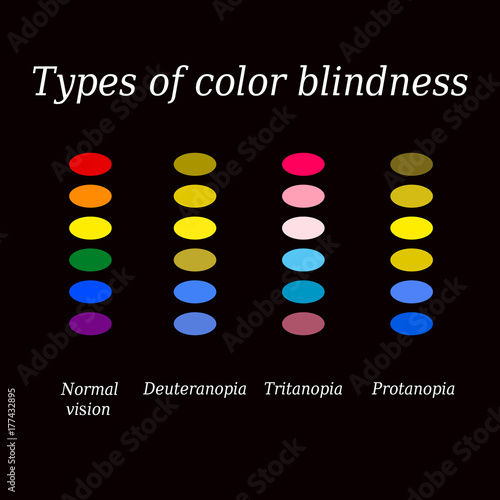 Types of color blindness. Eye color perception. Vector illustration on a black background