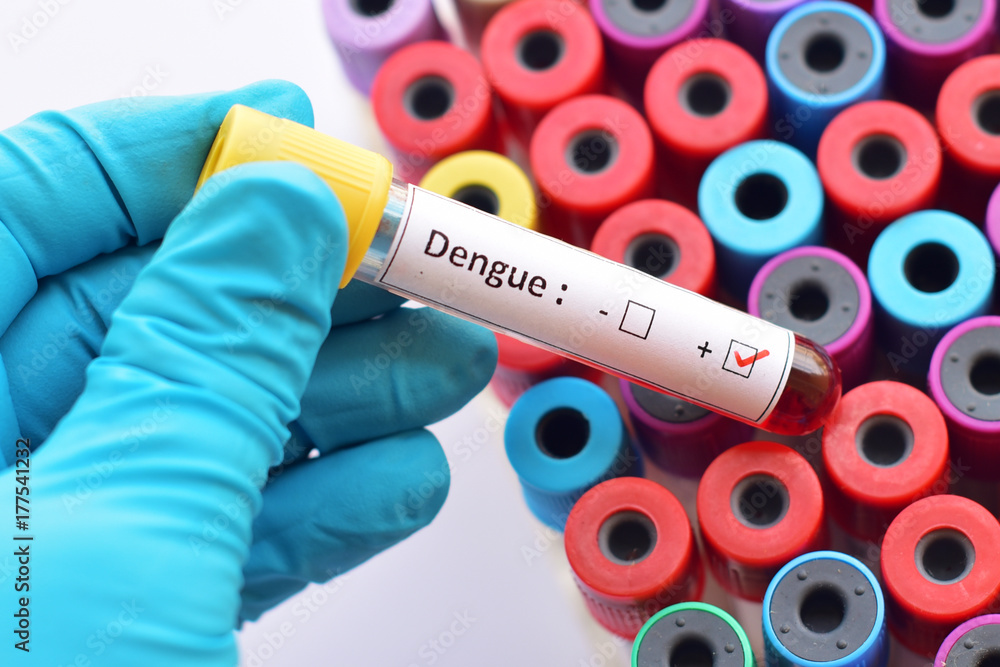 Fototapeta premium Dengue virus positive