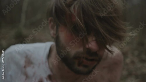 Beaten man with bloody wounds on his face wakes up in the forest alone