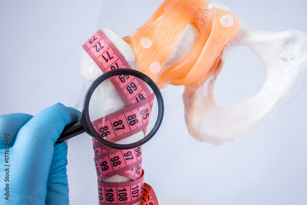 Bone Density Ruler Diagnosis of bone density and presence of osteoporosis photo idea ...