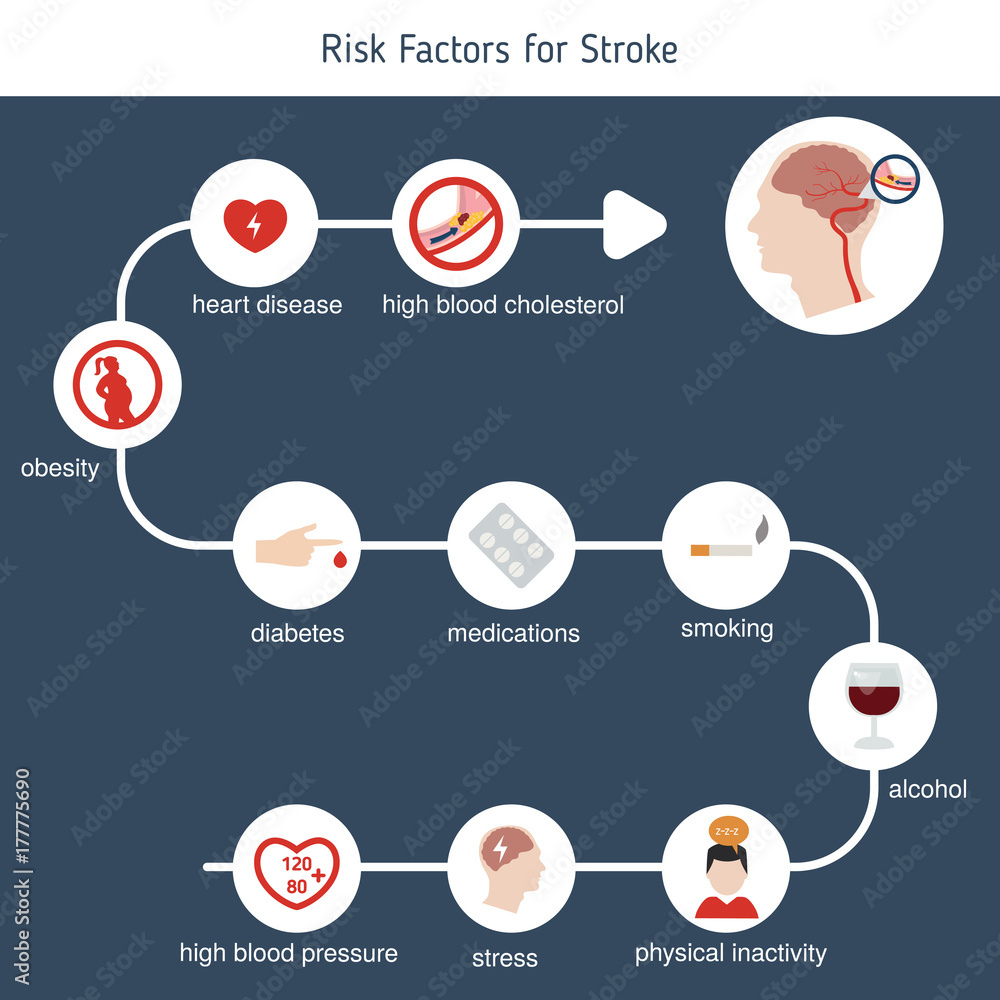 Fotografija Infographics for stroke