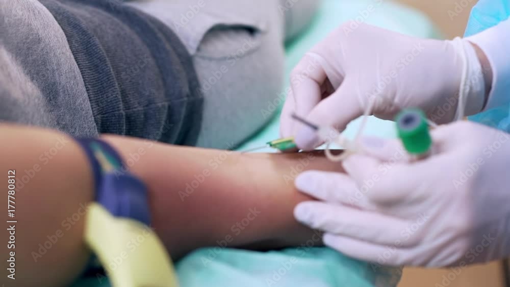 nurse collecting blood from patient vein who lying on medical bed in clinic, woman being tested closeup nurse collecting blood from patient vein who lying on medical bed in clinic, woman being tested closeup