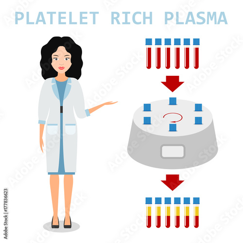 Platelet rich plasma. PRP method. Vector.