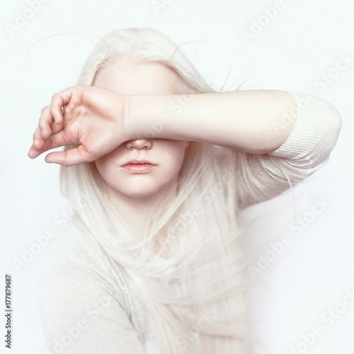 Albino girl with white skin, natural lips and white hair. Photo face on a light background. Portrait of the head. Blonde girl photo