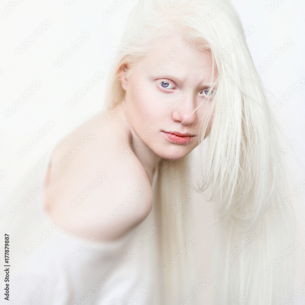Albino girl with white skin, natural lips and white hair. Photo face on a  light background. Portrait of the head. Blonde girl Stock Photo | Adobe  Stock