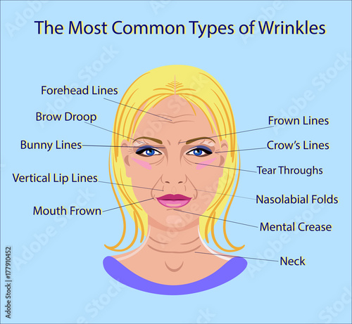 Common Types of Facial Wrinkles. cosmetic surgery. woman facial treatment isolated photo