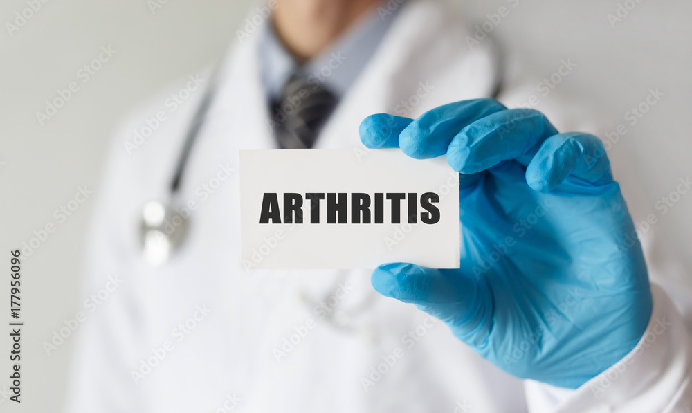 Doctor holding a card with text ARTHRITIS, medical concept Doctor holding a card with text ARTHRITIS, medical concept