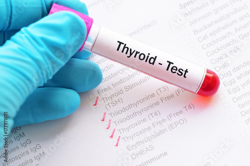 Thyroid hormone test photo