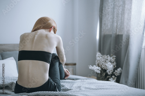 Woman with anorexia on bed photo