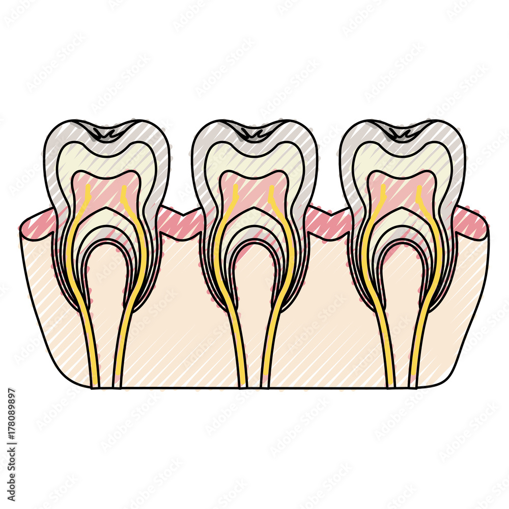 teeth with nerve and tooth root view in colored crayon silhouette teeth with nerve and tooth root view in colored crayon silhouette