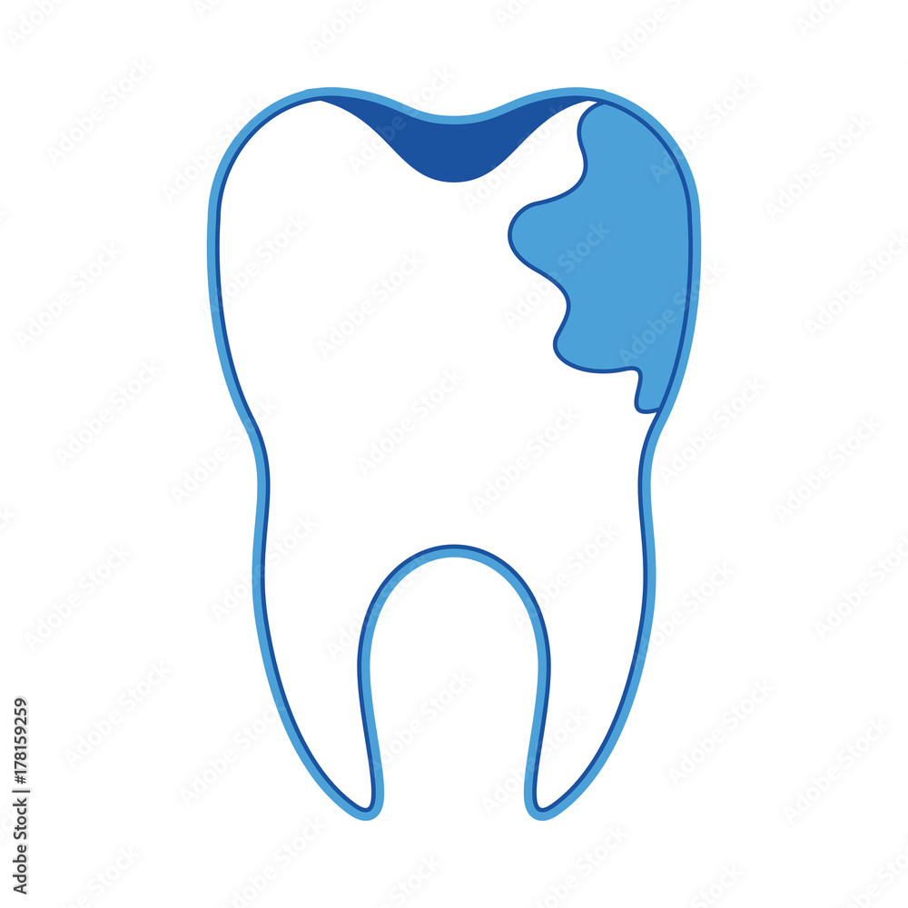 Obraz premium tooth with root and caries by side in blue silhouette