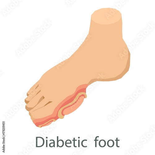 Diabetic foot icon, isometric style