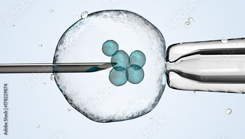 cell is holding by a pipet and a neeldle.