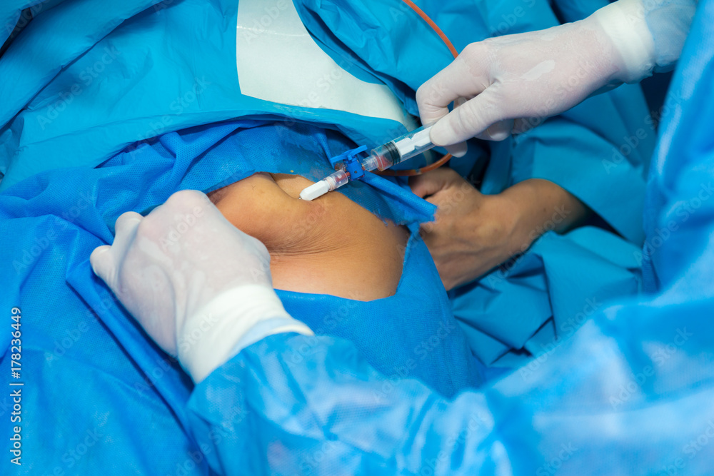 Subcutaneous fat removal. Surgeon's work in the operating theatre. Subcutaneous fat removal. Surgeon's work in the operating theatre.