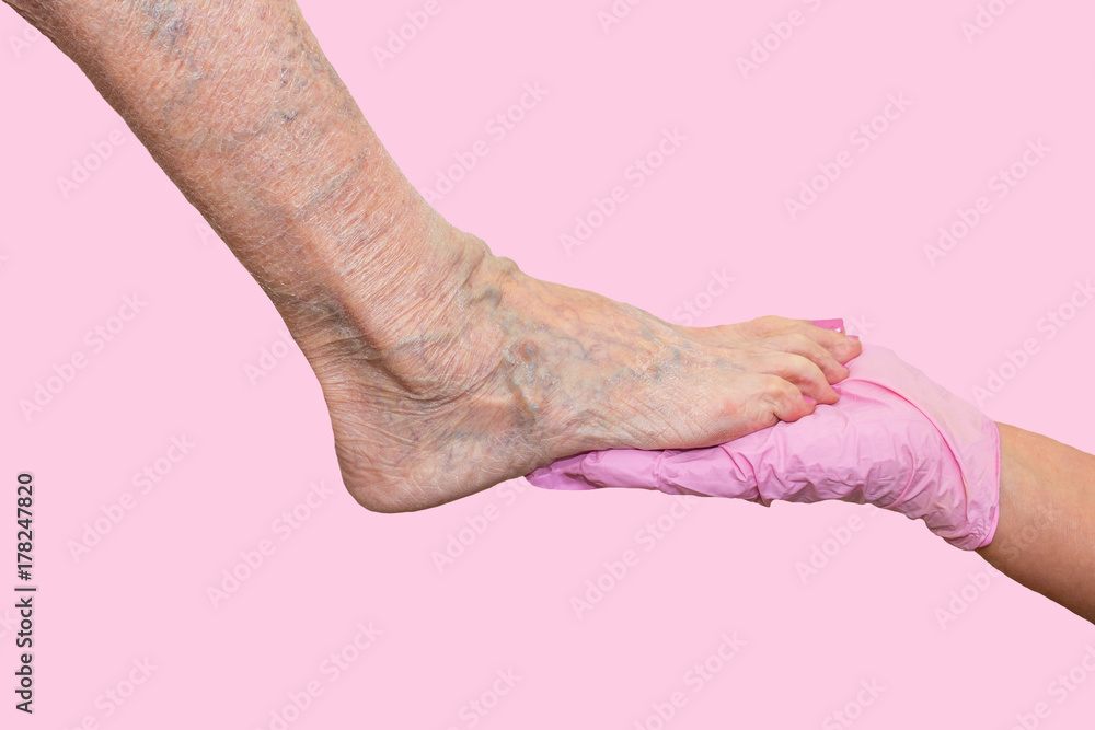 Ταπετσαρία Lower limb vascular examination because suspect of venous insufficiency