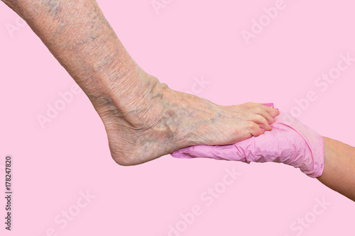 Lower limb vascular examination because suspect of venous insufficiency.