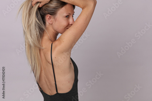 Checking benign moles : Portrait of Beautiful Woman with birthmarks on her back and face. Laser skin tags removal
