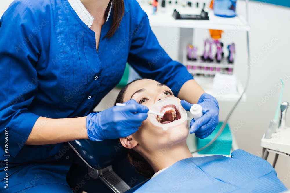 Dentist holding tooth whitening procedure Dentist holding tooth whitening procedure