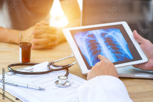 Doctor shows results to old patient x-ray of the lungs, smoking cigarettes problem