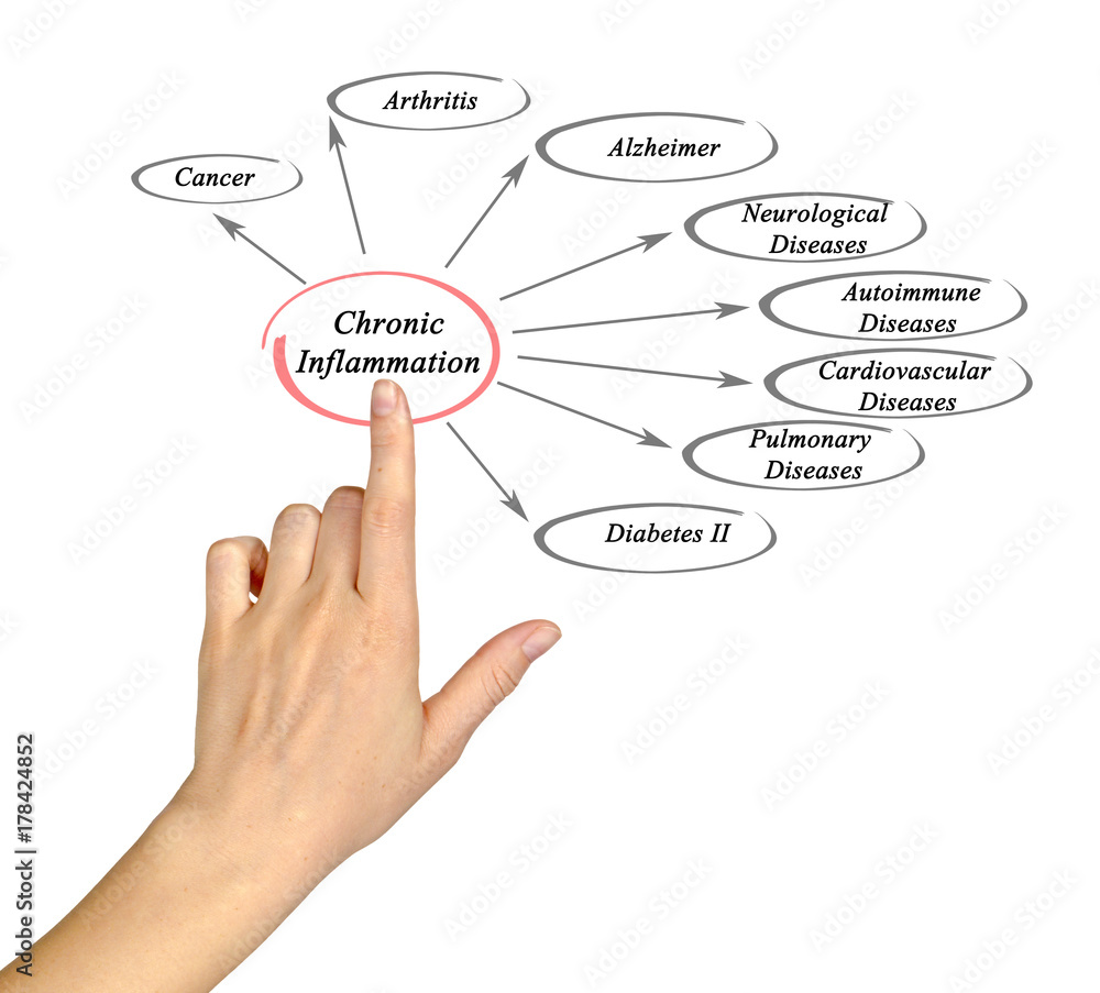 Chronic Inflammation Chronic Inflammation