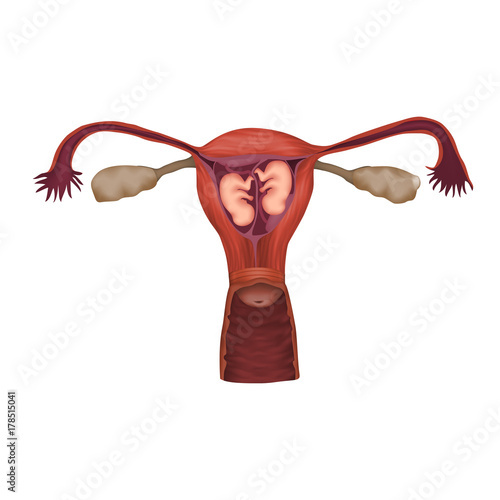 Dizygotic twins, embryo, fetus in uterus, placenta, umbilical cord. Vector medical illustration. Colored image, white background.