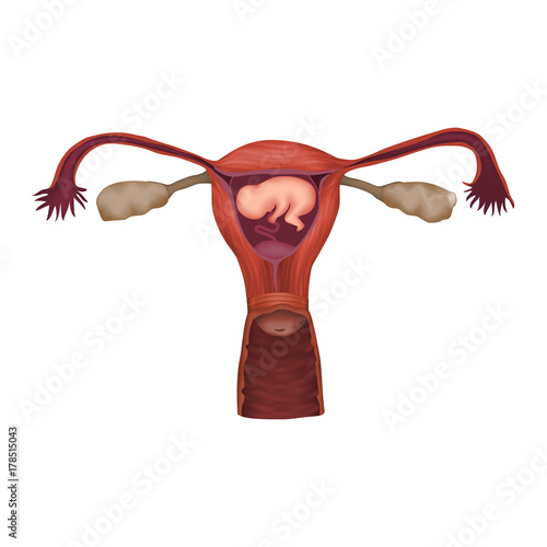 Placenta previa. Embryo, fetus in uterus, placenta, umbilical cord. Vector medical illustration. Colored image, white background.