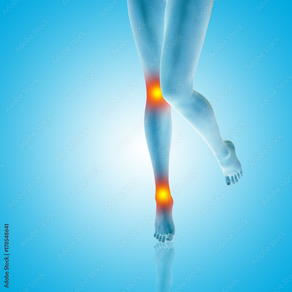 Conceptual beautiful woman or girl legs and feet with a hurt knee and ankle pain or ache. 3D illustration of human slim fit body medical health care concept, painful sport injury on blue background Conceptual beautiful woman or girl legs and feet with a hurt knee and ankle pain or ache. 3D illustration of human slim fit body medical health care concept, painful sport injury on blue background