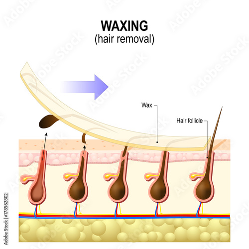 Hair removal. Waxing