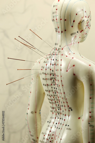 Fototapeta Naklejka Na Ścianę i Meble -  female acupuncture model with needles in the shoulder