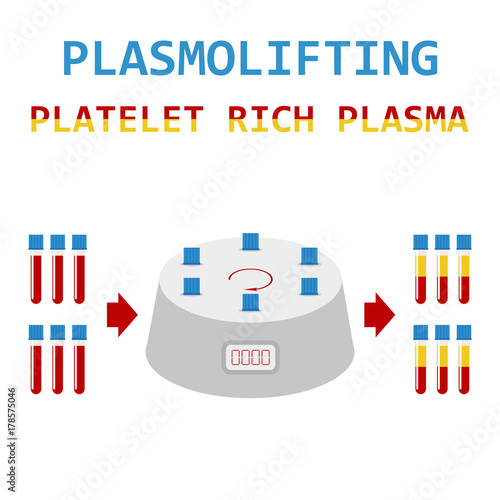Plasmolifting. Platelet rich plasma. PRP method. Vector.