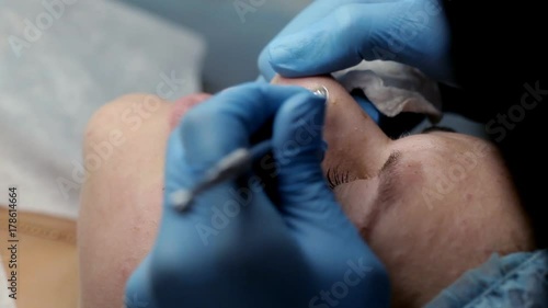 The beautician makes a cleansing of the nose area during the procedure of mechanical facial cleansing photo