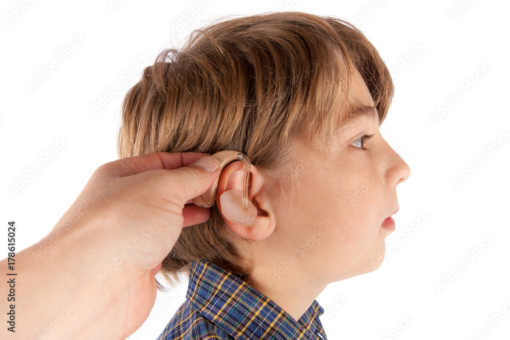 Audiologis inserting a hearing aid in a young boy patient's ear. Audiologis inserting a hearing aid in a young boy patient's ear.