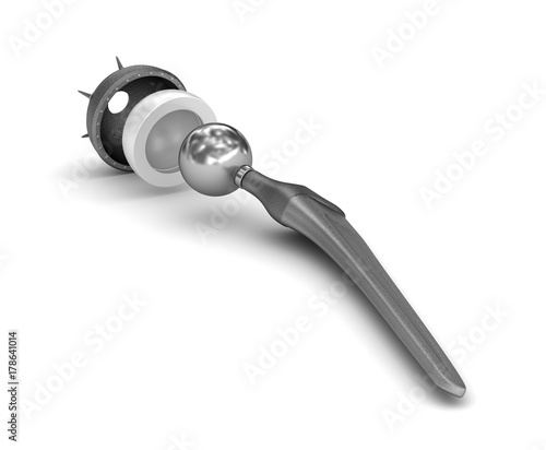 Hip replacement implant isolated on white. Medically accurate 3D illustration
