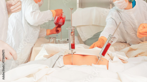 Εκτύπωση καμβά bone marrow transplant operation
