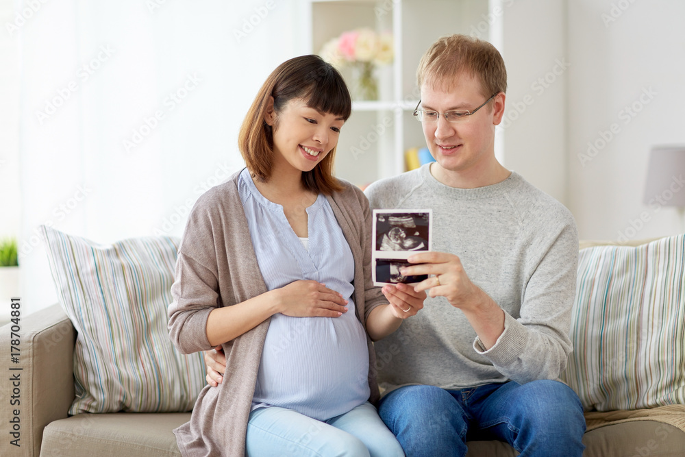 Obraz premium happy couple with ultrasound images at home
